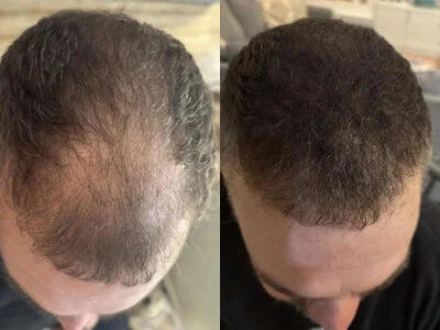 Cache-Cheveux Minéral — photo d'un client 2